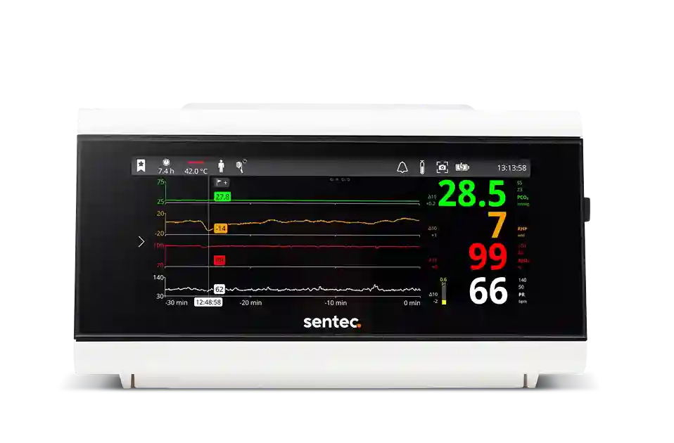 Sentec Dijital İzleme Sistemi